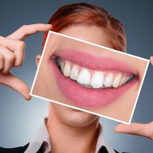 Ästhetische Zahnkorrekturen